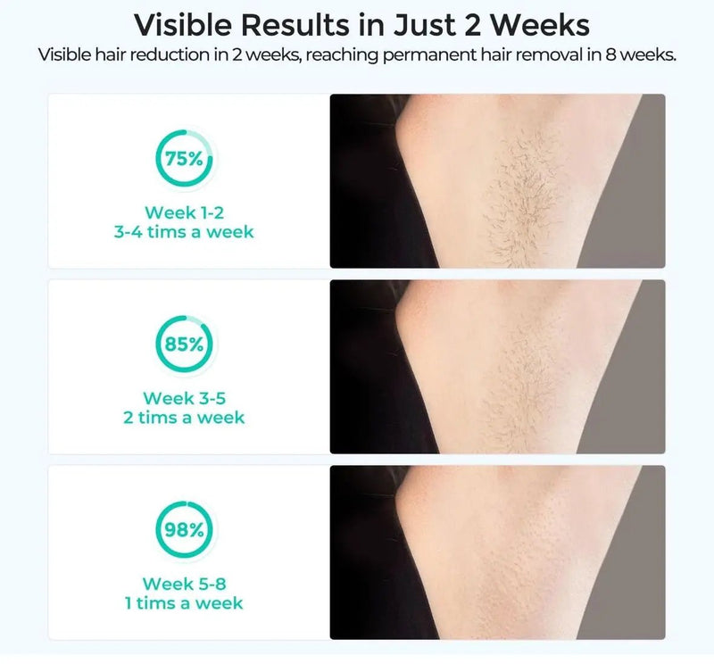 Open Box LUBEX Laser Hair Removal for Women and Men, Permanent IPL Hair Removal Device with IGBT Technology(3-Minute Whole Body Hair Removal), at Home by Selzalot